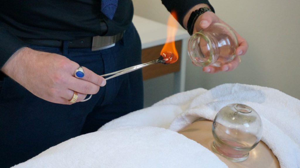 Cupping Therapy: Explore the Healing Benefits in Melbourne
