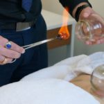 Cupping Therapy: Explore the Healing Benefits in Melbourne